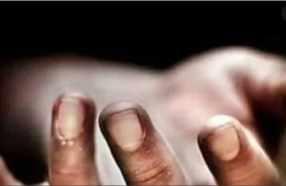 مرگ بیش از ۵۳۰۰ نفر بر اثر اعتیاد در ۱۴۰۰ مرگ بیش از ۵۳۰۰ نفر بر اثر اعتیاد در ۱۴۰۰