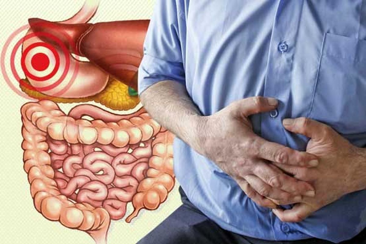 عامل مهم ابتلا به سرطان معده عامل مهم ابتلا به سرطان معده